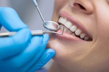 Wybielanie zębów &#8211; jak i dlaczego warto, a dlaczego nie?