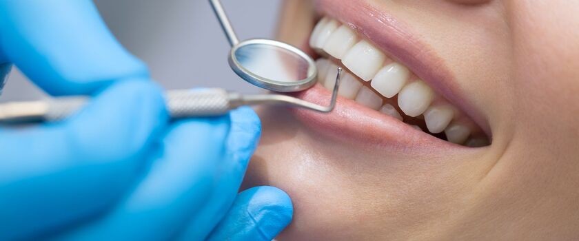 Wybielanie zębów &#8211; jak i dlaczego warto, a dlaczego nie?