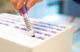 Brytyjczycy zapowiadają testy kliniczne sztucznej krwi