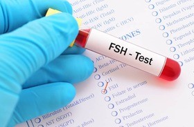 FSH – badanie, norma, za wysokie, za niskie. Czy poziom hormonu folikulotropowego wpływa na płodność i rozwój PCOS?
