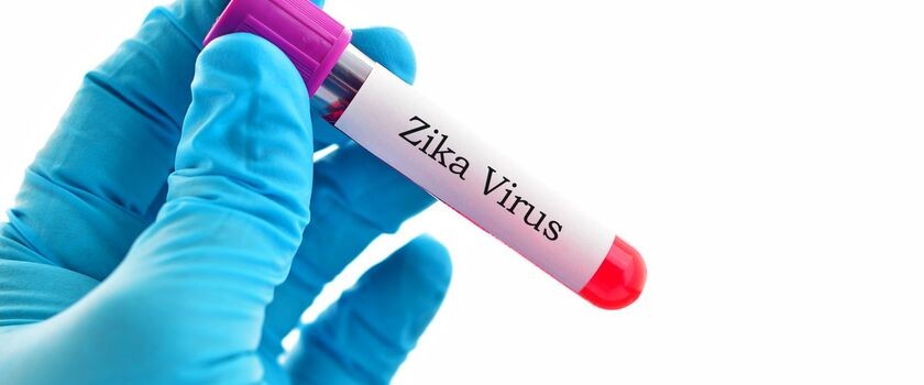 To pewne &#8211; wirus Zika wywołuje mikrocefalię