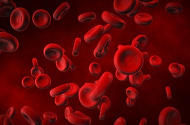 Sferocytoza – objawy, przyczyny, diagnostyka i leczenie