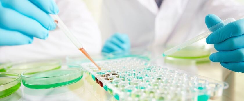 Wykryłeś przeciwciała HCV i co dalej?