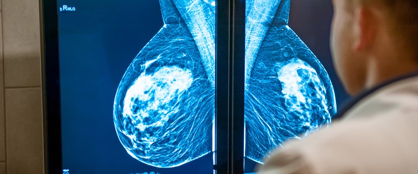 Mammografia pomaga wykryć problemy z sercem