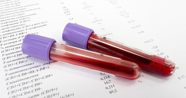 Jakie podstawowe badania krwi wykonywać i jak często je powtarzać?