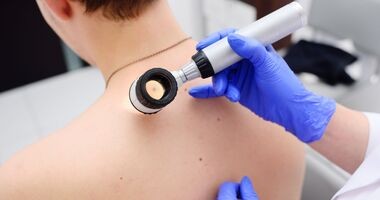 dermatoskopia, badanie znamion, badanie pieprzyków, badanie u dermatologa