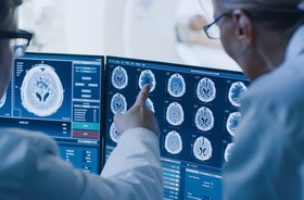 Lekarze analizują skan mózgu (CT mózgu)