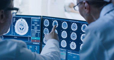 Lekarze analizują skan mózgu (CT mózgu)