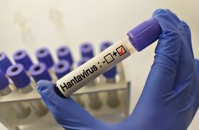 hantawirus, probówka z krwią zakażoną hantawirusem