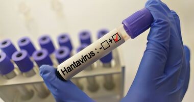 hantawirus, probówka z krwią zakażoną hantawirusem