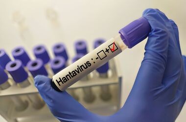 hantawirus, probówka z krwią zakażoną hantawirusem