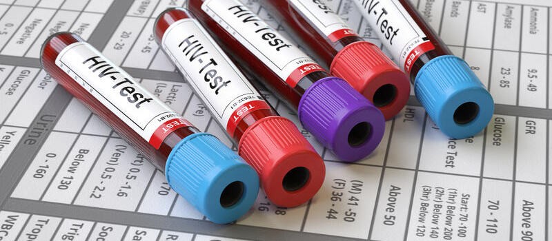 Genetyczna terapia HIV wchodzi w fazę badań klinicznych