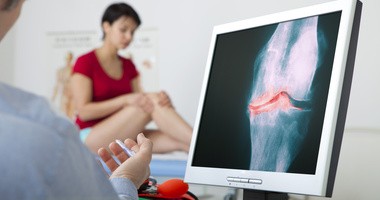 Pacjentka z gonartrozą trzyma się za staw kolanowy, lekarz ogląda RTG kolana