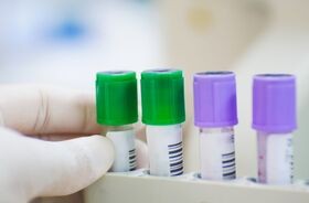 lit, badanie poziomu litu, próbki krwi do badania litu, stabilizatory nastroju