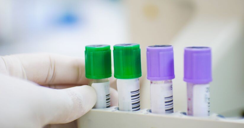 lit, badanie poziomu litu, próbki krwi do badania litu, stabilizatory nastroju