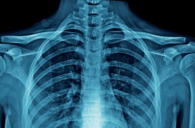 Ból kręgosłupa piersiowego – przyczyny, diagnostyka, leczenie, ćwiczenia na odcinek piersiowy kręgosłupa