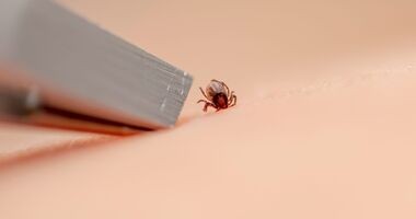 usuwanie kleszcza za pomocą pęsety