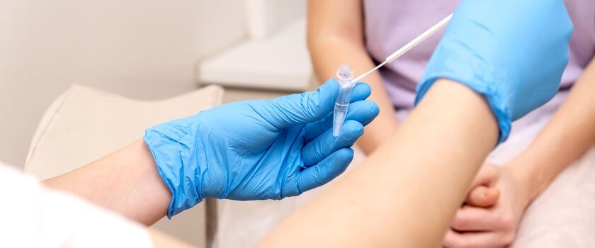 cytologia płynna, cytologia LBC, LBC, test na HPV, cytologia na NFZ