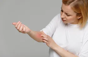 Problemy skórne a COVID-19 – wysypki, rumień, wypadanie włosów