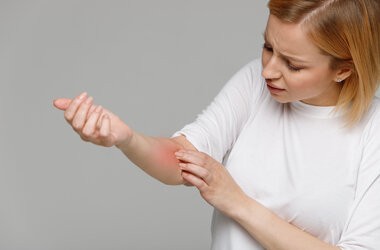 Problemy skórne a COVID-19 – wysypki, rumień, wypadanie włosów