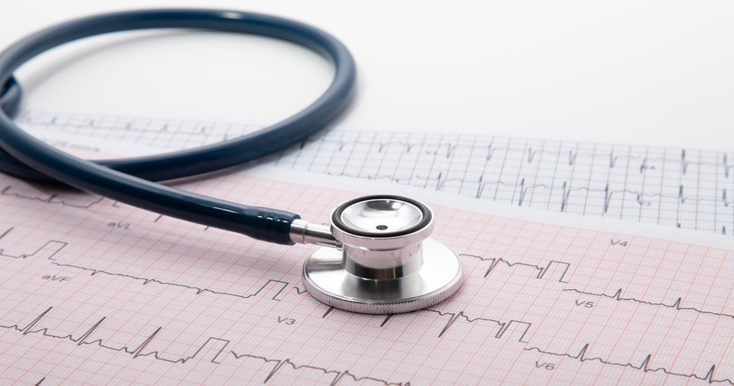 jak moze wyglądać zapis ekg serca