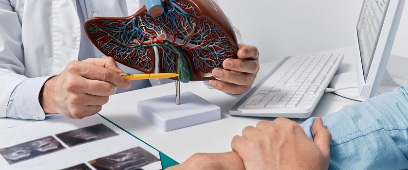 WZW, wirusowe zapalenie wątroby, objawy wirusowego zapalenia wątroby, rodzaje wirusowego zapalenia wątroby, wiruswe zapalenie wątroby typu, lekarz pokazuje pacjentowi model wątroby