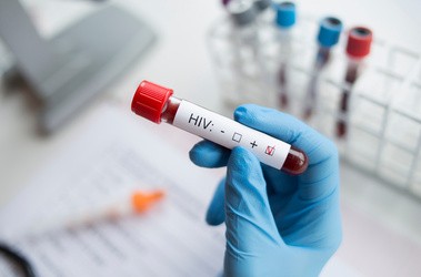 Probówka z krwią podczas badania na HIV