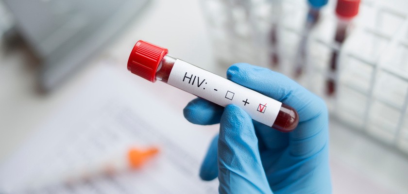 Probówka z krwią podczas badania na HIV