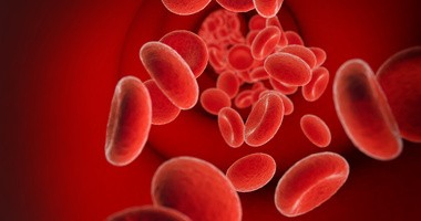 Czerwienica (prawdziwa i rzekoma) - objawy i leczenie nadkrwistości