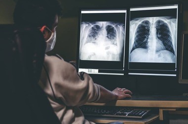 RTG klatki piersiowej  – badanie, wskazania, przeciwwskazania, refundacja i cena prześwietlenia