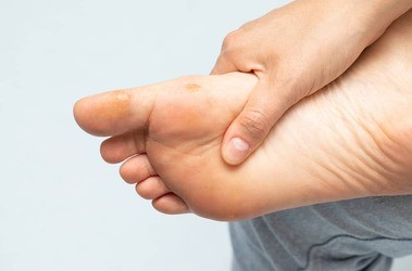 Domowe sposoby na odciski – czyli jak pozbyć się piekącego problemu stóp?