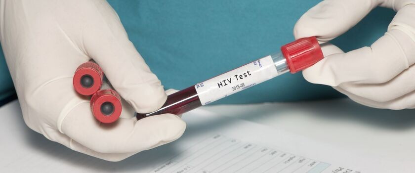 Liczba zakażeń wirusem HIV w Polsce rośnie