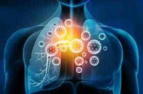Grafiak przedstawiające autoimmunologiczną chorobę płuc