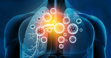 Grafiak przedstawiające autoimmunologiczną chorobę płuc