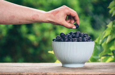 Dieta przy łuszczycy – jak powinna wyglądać?