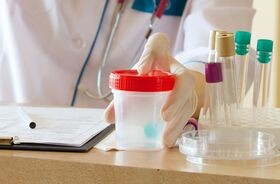 Pojemniki na mocz na biurku medyka. Badanie ogólne moczu, ogólne badanie moczu, badanie moczu normy.