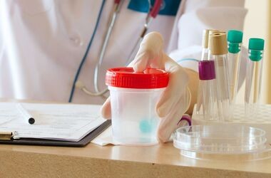 Pojemniki na mocz na biurku medyka. Badanie ogólne moczu, ogólne badanie moczu, badanie moczu normy.