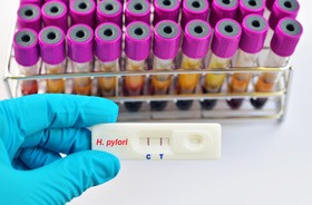 Test ureazowy na Helicobacter pylori – na czym polega i kiedy się go wykonuje? Przebieg i wyniki testu ureazowego na H. pylori