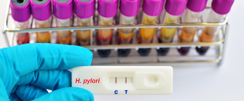 Test ureazowy na Helicobacter pylori – na czym polega i kiedy się go wykonuje? Przebieg i wyniki testu ureazowego na H. pylori
