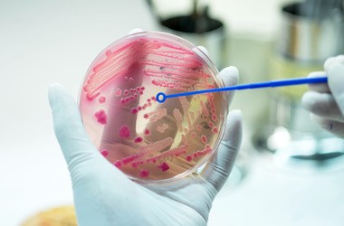 e.coli, e.coli pod mikroskopem, escherichia coli pod mikroskopem