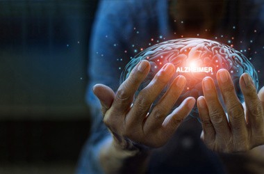 Grafika przedstawiająca mózg i słowo Alzheimer