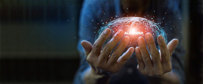 Grafika przedstawiająca mózg i słowo Alzheimer