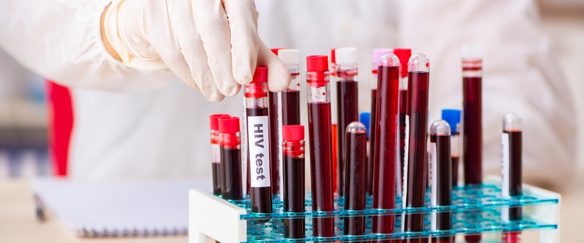 Druga osoba na świecie skutecznie wyleczona z HIV