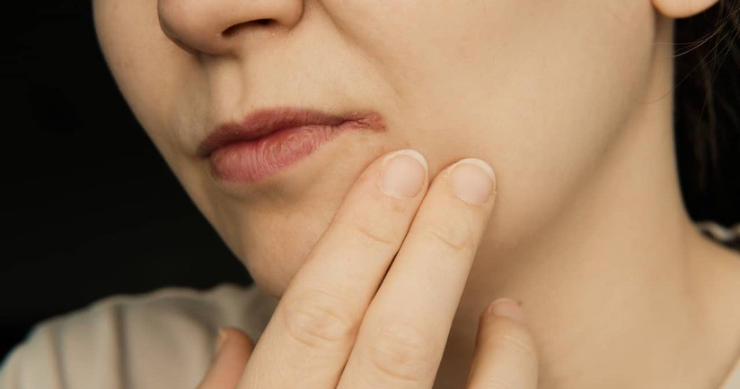 zajady w kącikach ust