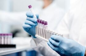 APOLIPOPROTEINA B, dłonie w rękawiczkach trzymają probówki