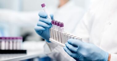 APOLIPOPROTEINA B, dłonie w rękawiczkach trzymają probówki