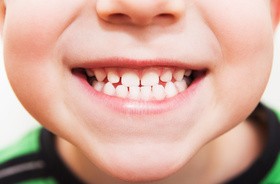 Lakowanie zębów u dzieci – czy jest konieczne?
