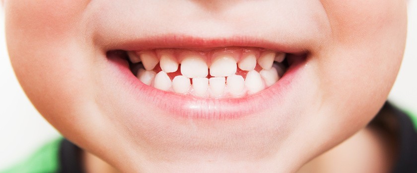 Lakowanie zębów u dzieci – czy jest konieczne?
