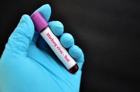 próbka krwi do testu na wirusa Marburg