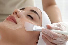 kwas tca, peeling z kwasem tca, tca na trądzik, kobieta podczas zabiegu peelingu tca